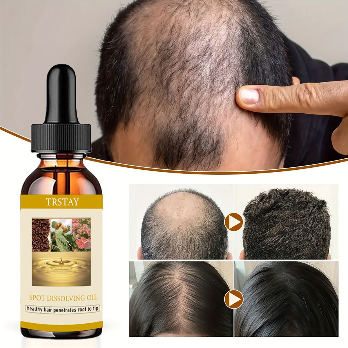 50ML Beard Growth Oil Anti Alo - Beard Oil 评论和价格