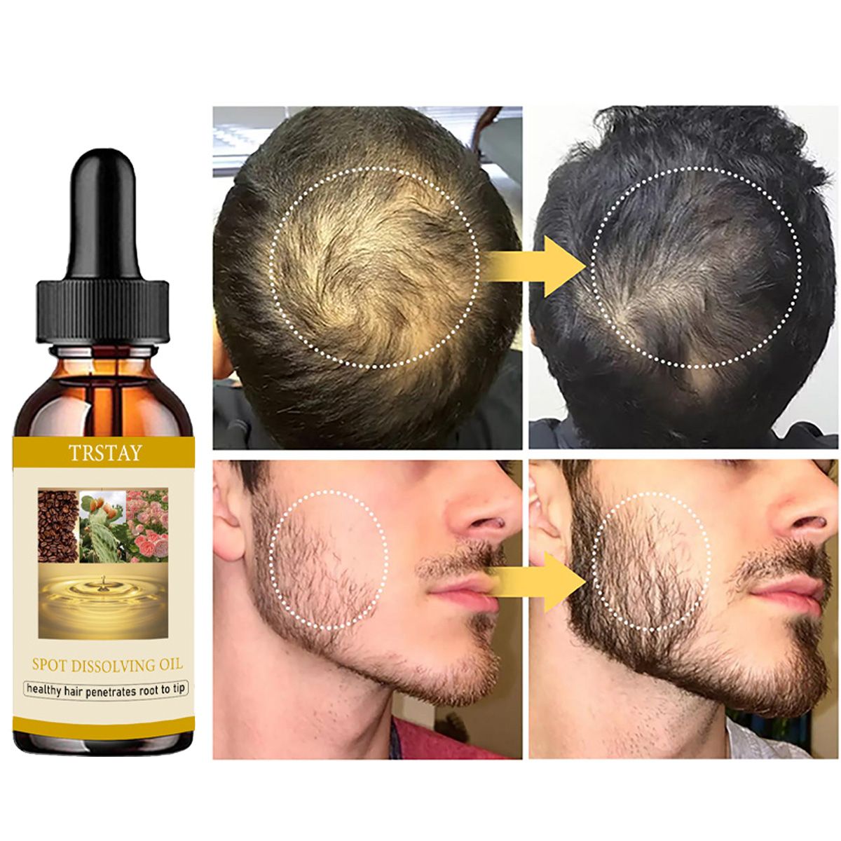 50ML Beard Growth Oil Anti Alo - Beard Oil 评论和价格